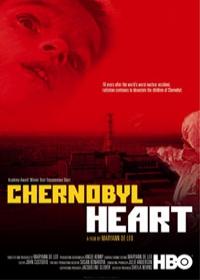 Csernobil szívbaj (Chernobyl Heart)
